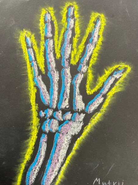 Handknochen mit neongelber Umrandung auf schwarzem Untergrund - Zeichnung wie ein Röntgenbild.